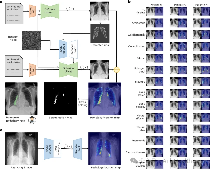 Nature Biomedical Engineering IF=26.6 | PIXEL模型实现胸部X光像素级病理定位 - 知乎