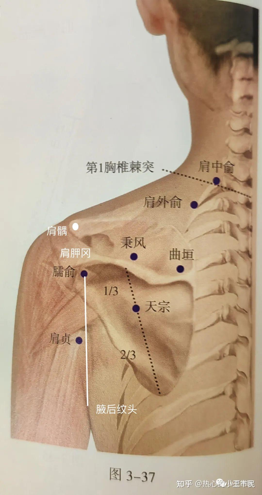 天宗的位置图片大全图片