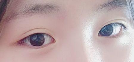 有一双假双眼皮的单眼皮是什么体验? - 知乎