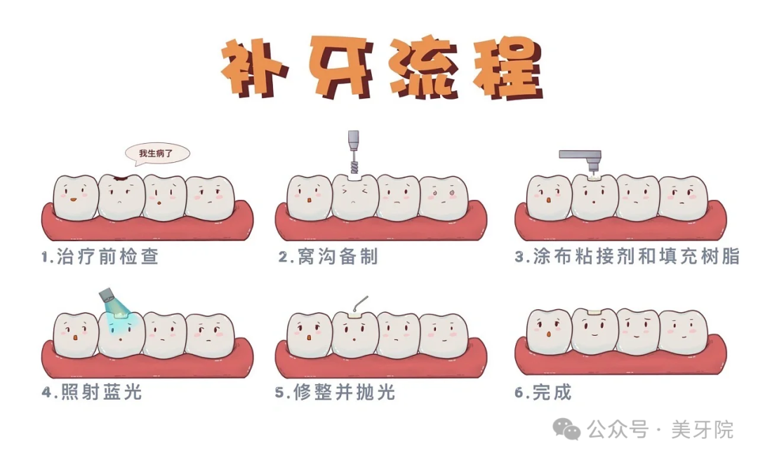 为什么补了牙 ,真牙还会继续蛀?难道补牙是一个骗局?我们的钱白花了吗? - 知乎