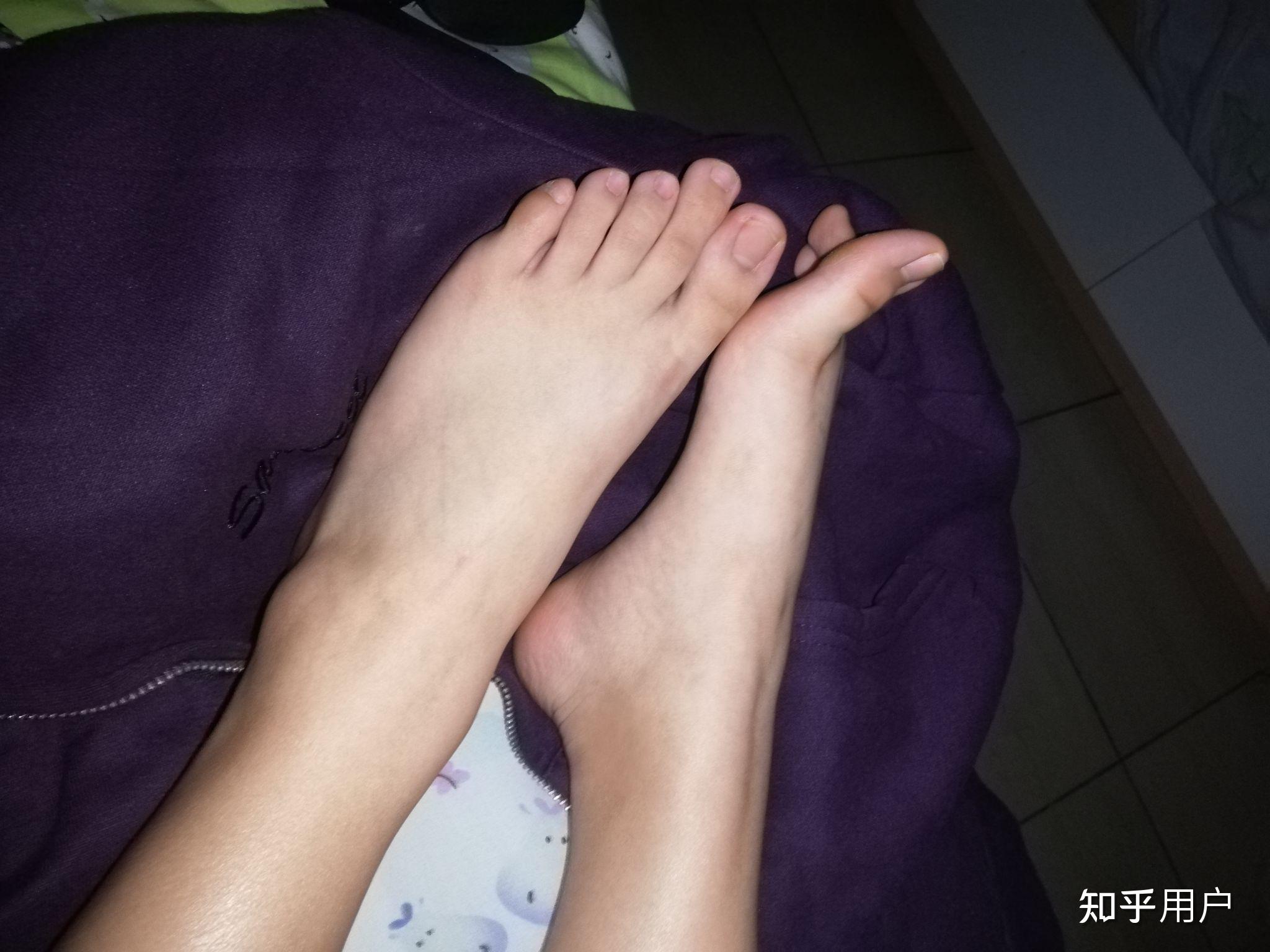 69希腊脚69真的69很少见69吗69? - 知乎