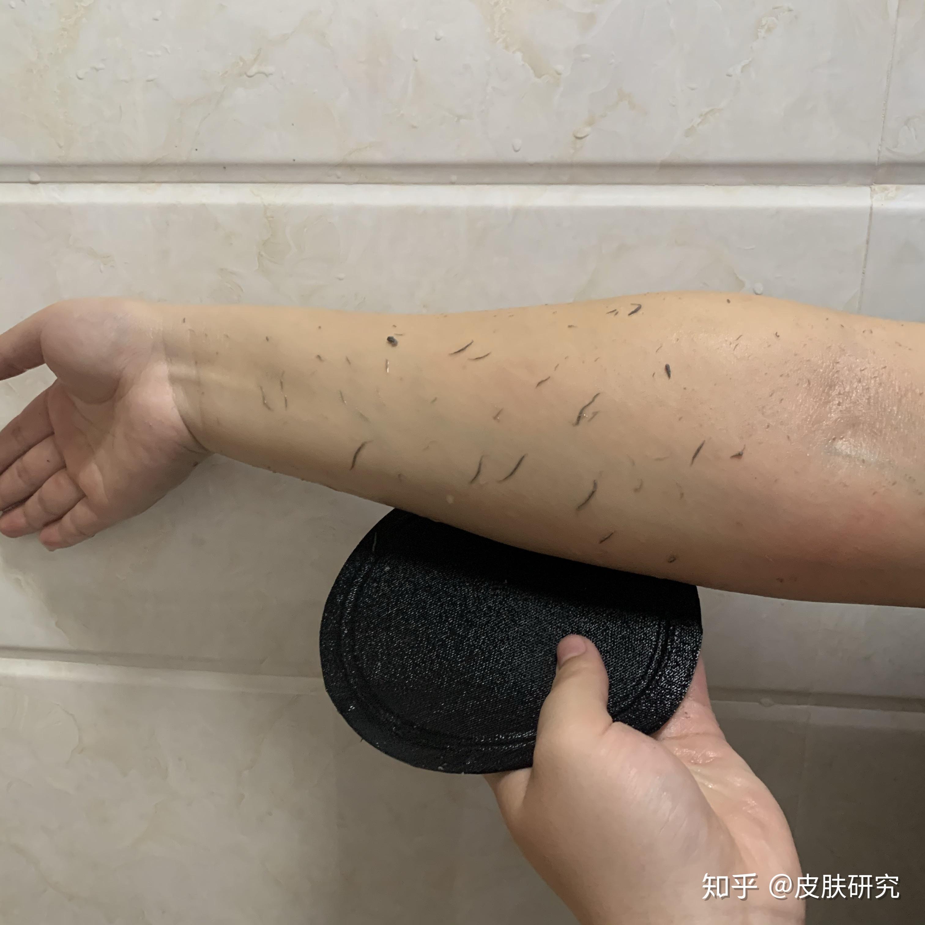 鸡皮肤搓澡工具推荐(用澡巾使劲搓可以去鸡皮肤吗)
