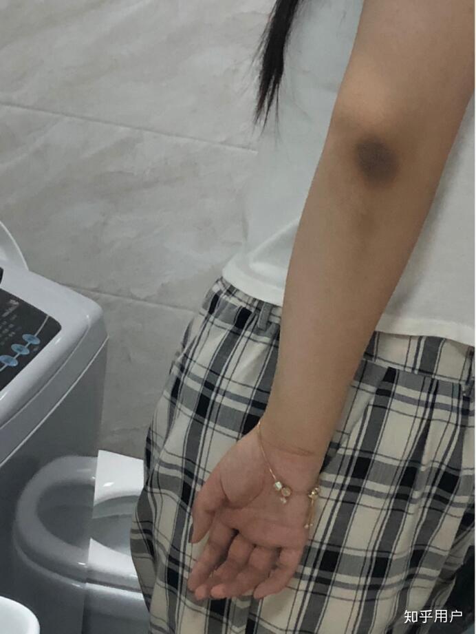 有哪些可以去手肘膝盖黑的磨砂膏?