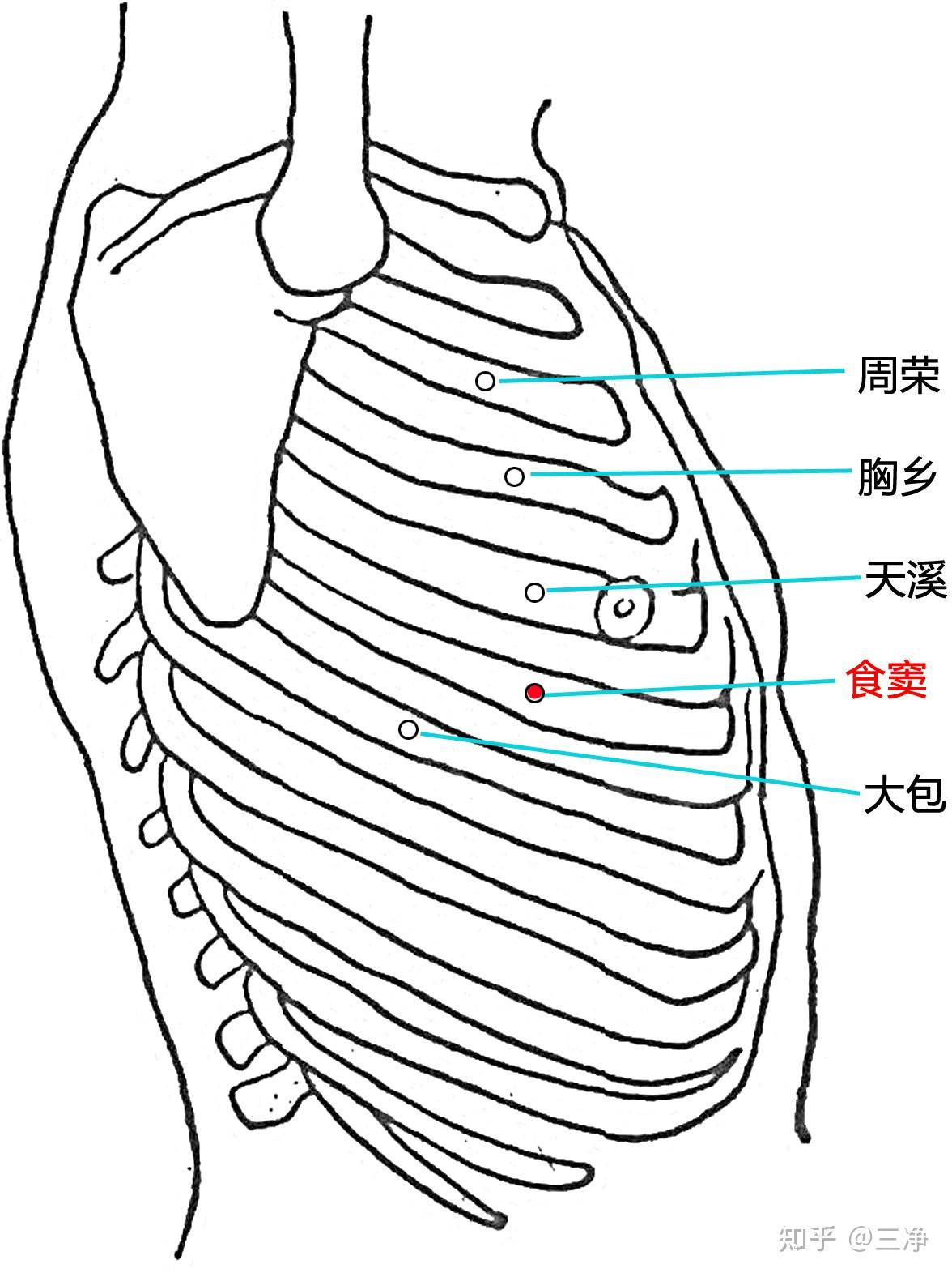 横窦乙状窦定位图片