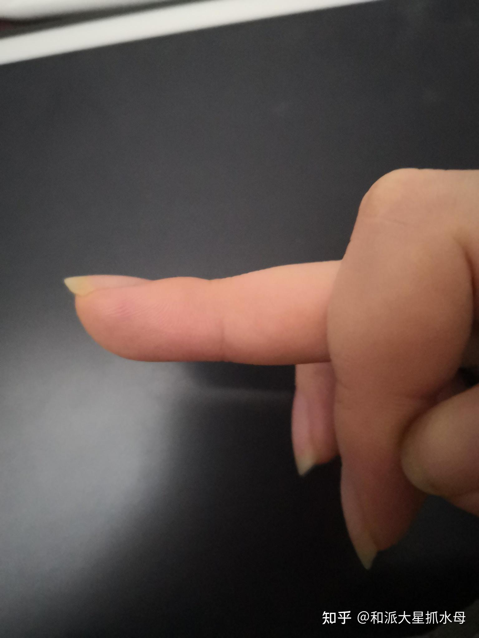 我害怕我写字会导致中指有茧子,怎么办? - 知乎