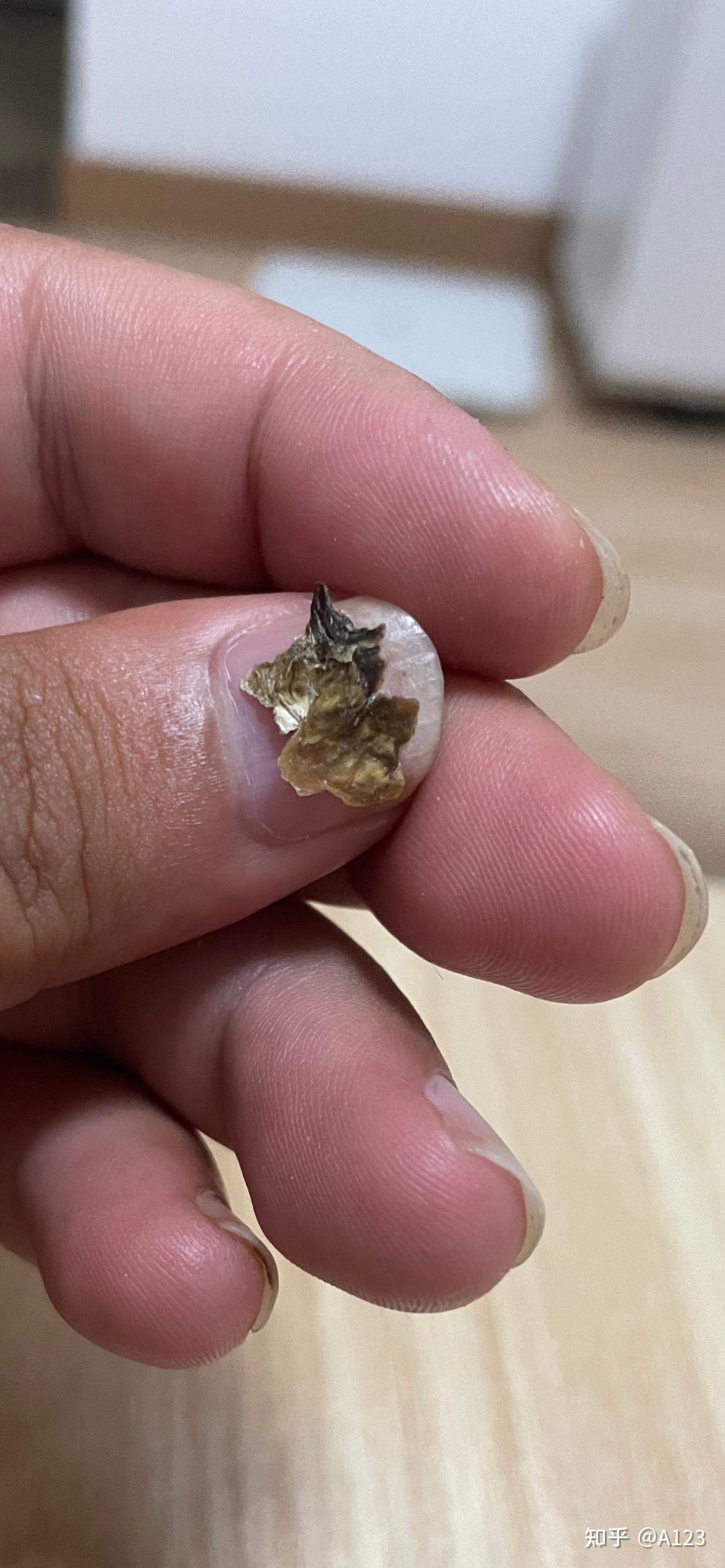 你们掏出来的耳屎有多大? - 知乎