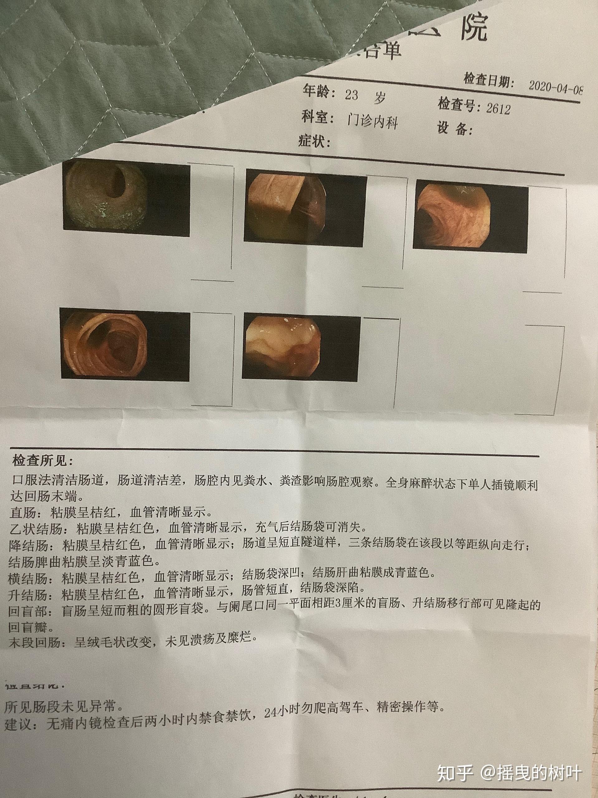 我想做腸鏡胃鏡檢查醫生說你這個年紀沒必要做