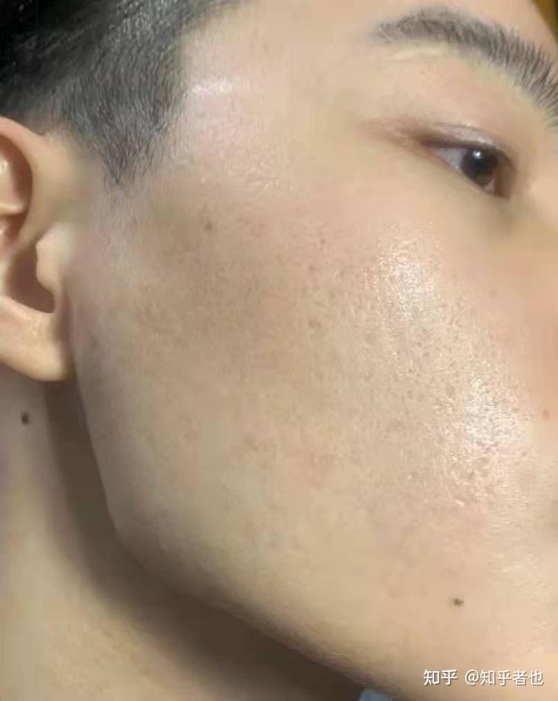 我是男生,皮肤暗黄黑,怎么能让皮肤变白? - 知乎
