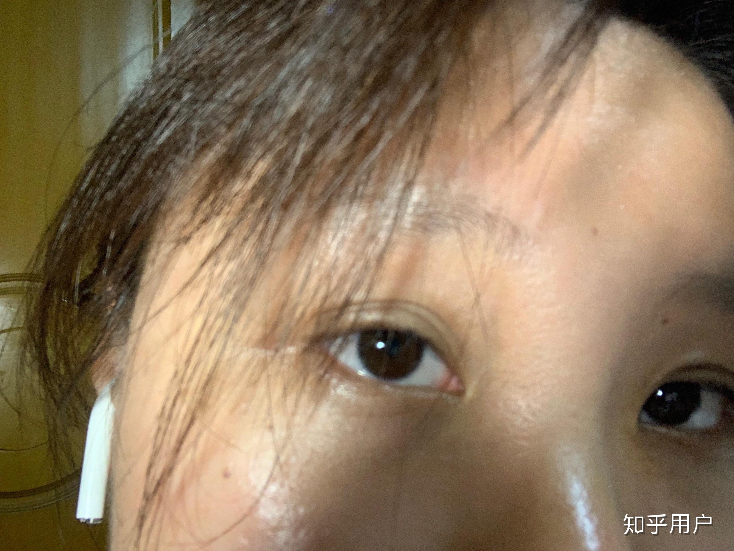 得了抑郁症的人眼神是不是都是一样的?