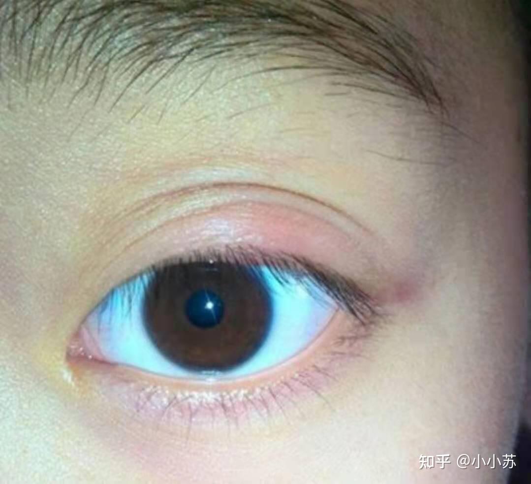 种睫毛好流行好漂亮,我也想尝试,但到底有没有坏处?