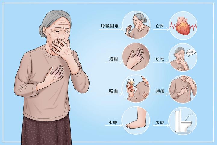 2022年春节送礼选购制氧机必看国产吸氧机哪个牌子好