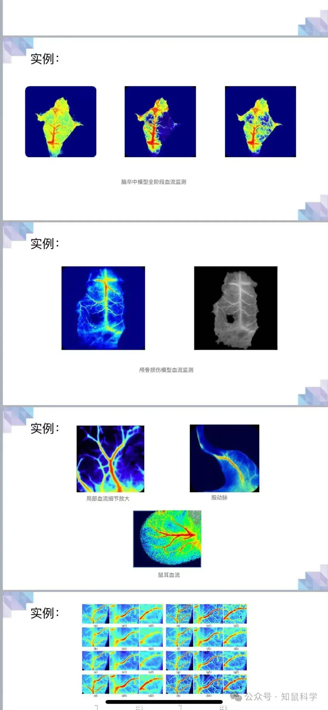 科研前沿探索与多模态应用--激光散斑对比成像技术 - 知乎