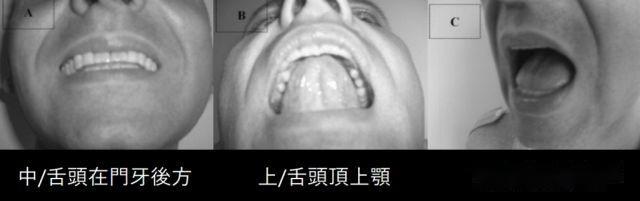 舌头,掌舵你的深层筋膜 - 知乎