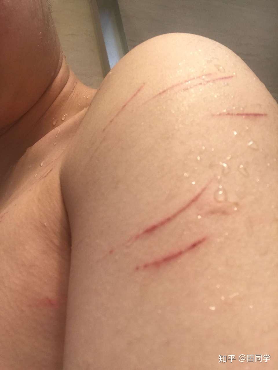为什么身上会有莫名其妙的抓痕