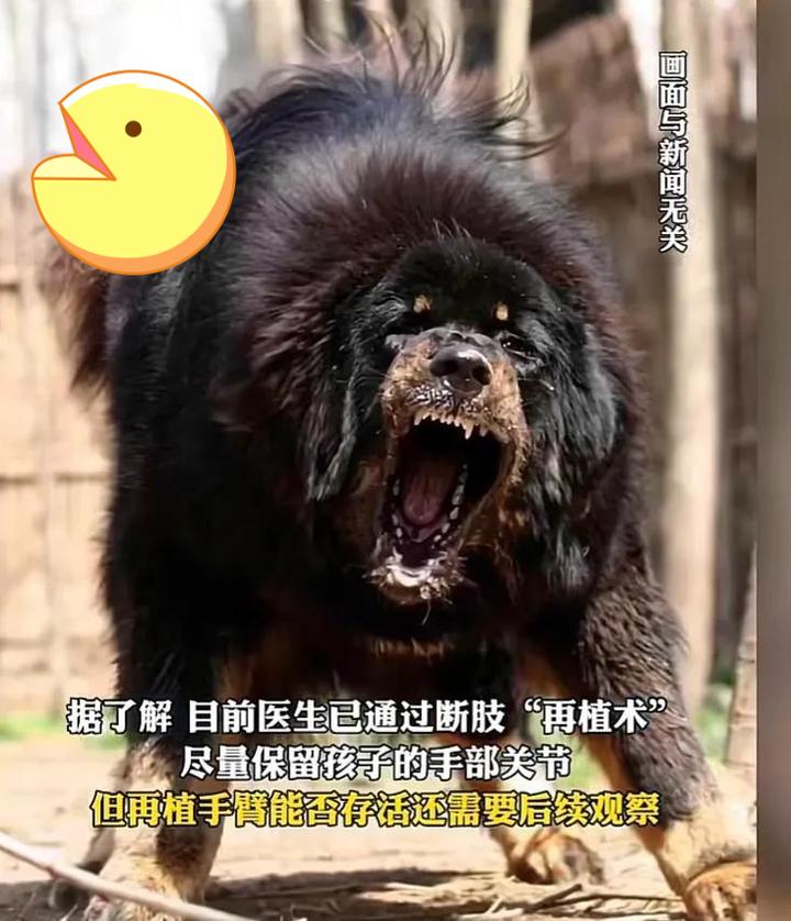 1岁半男童手臂被藏獒咬断更多细节曝光
