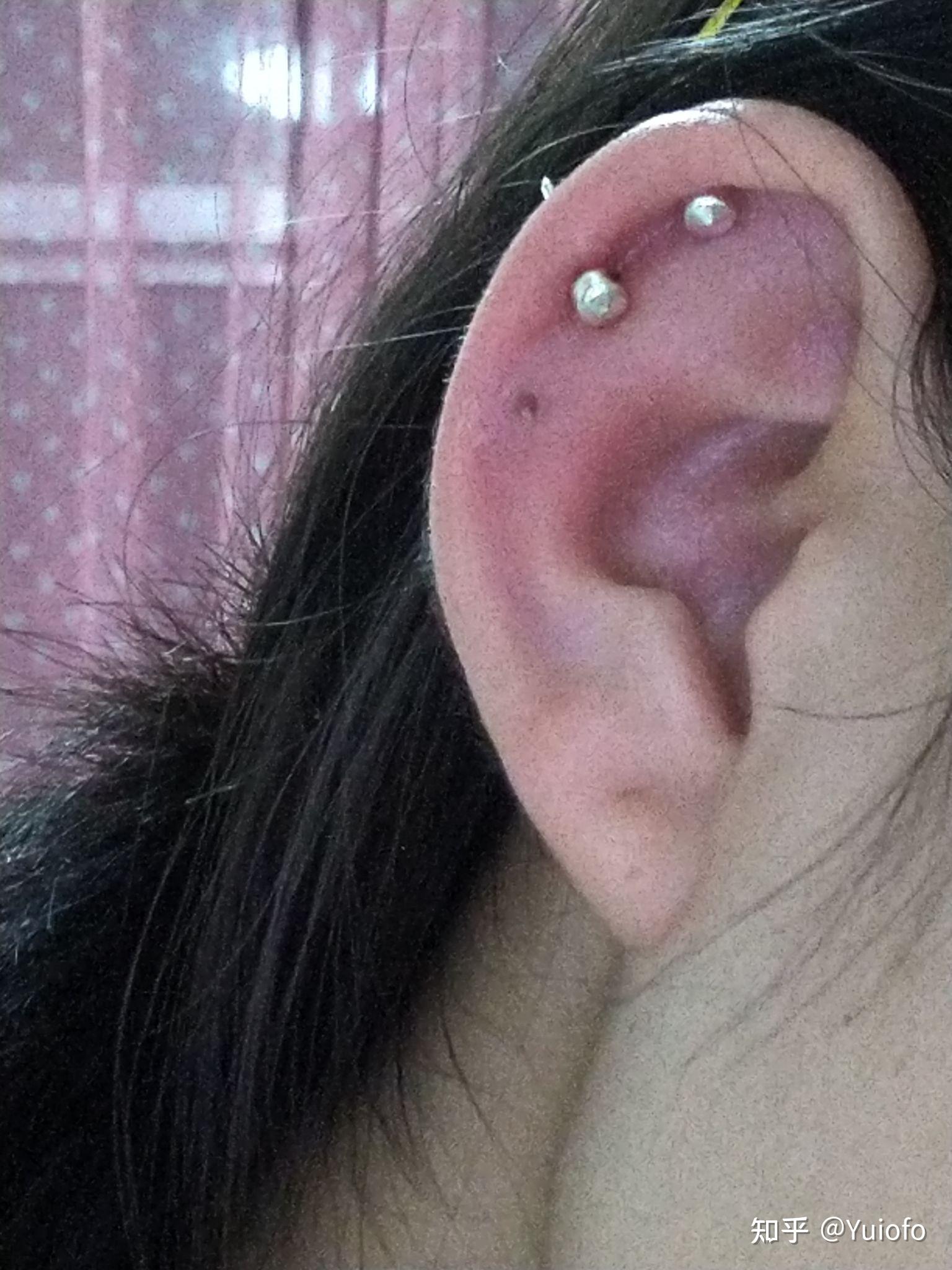 打耳骨洞多久可以换耳钉? - 知乎
