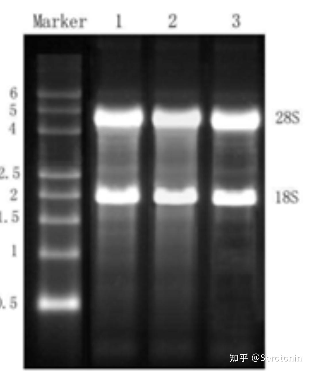 如何判读RNA电泳图？ - 知乎