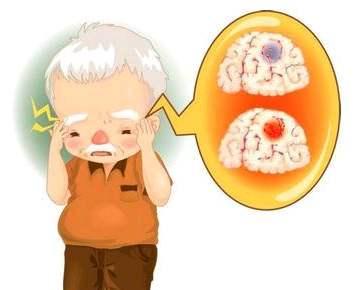 什么原因会引起脑梗呢 v2-d7e167fd9440eaeec3c54d3985252f43_1440w.jpg?source=172ae18b