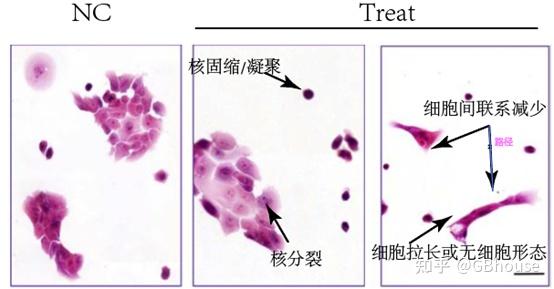 形态学免疫组化免疫荧光四部曲-苏木素&伊红染色 - 知乎