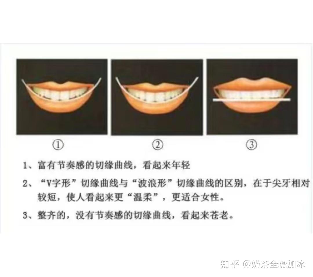 谁看谁心动的治愈笑容， 牙齿矫正后的你是属于哪种笑容？ - 知乎