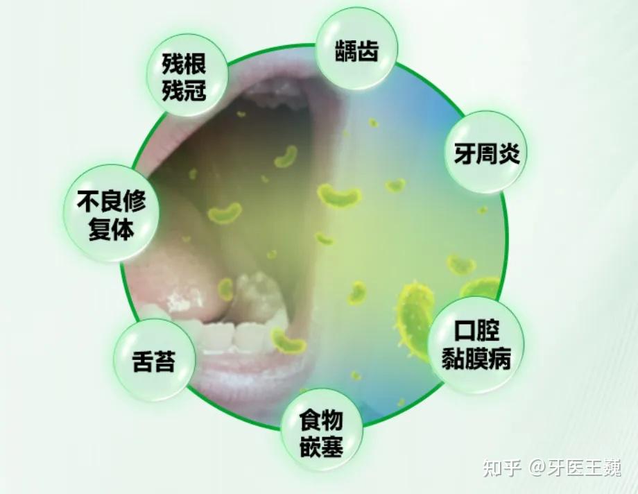 好消息!PHP口气检测口臭防治门诊——让你告别开口尴尬 - 知乎