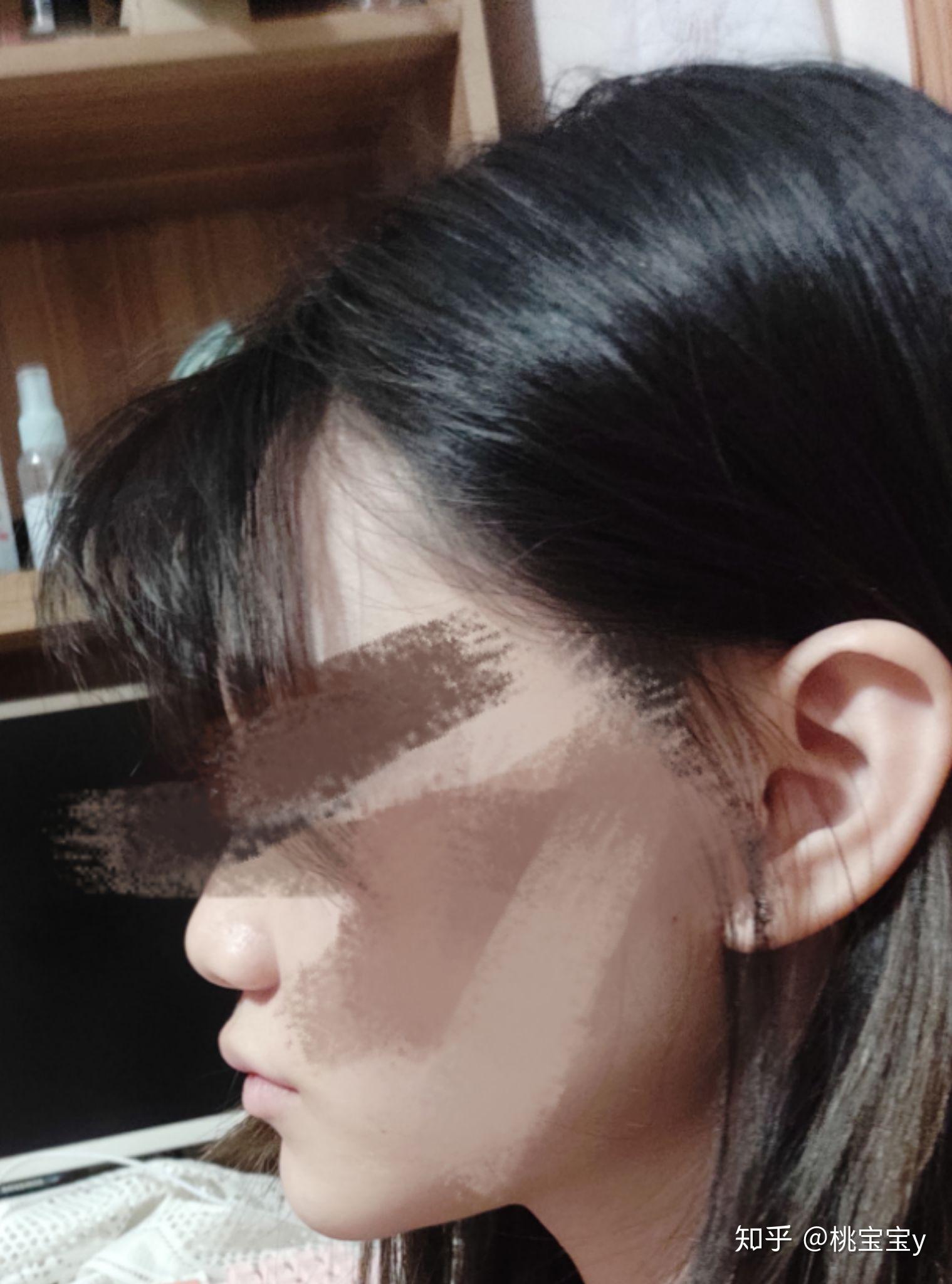 翘下巴月亮脸鞋拔子脸是不是很丑
