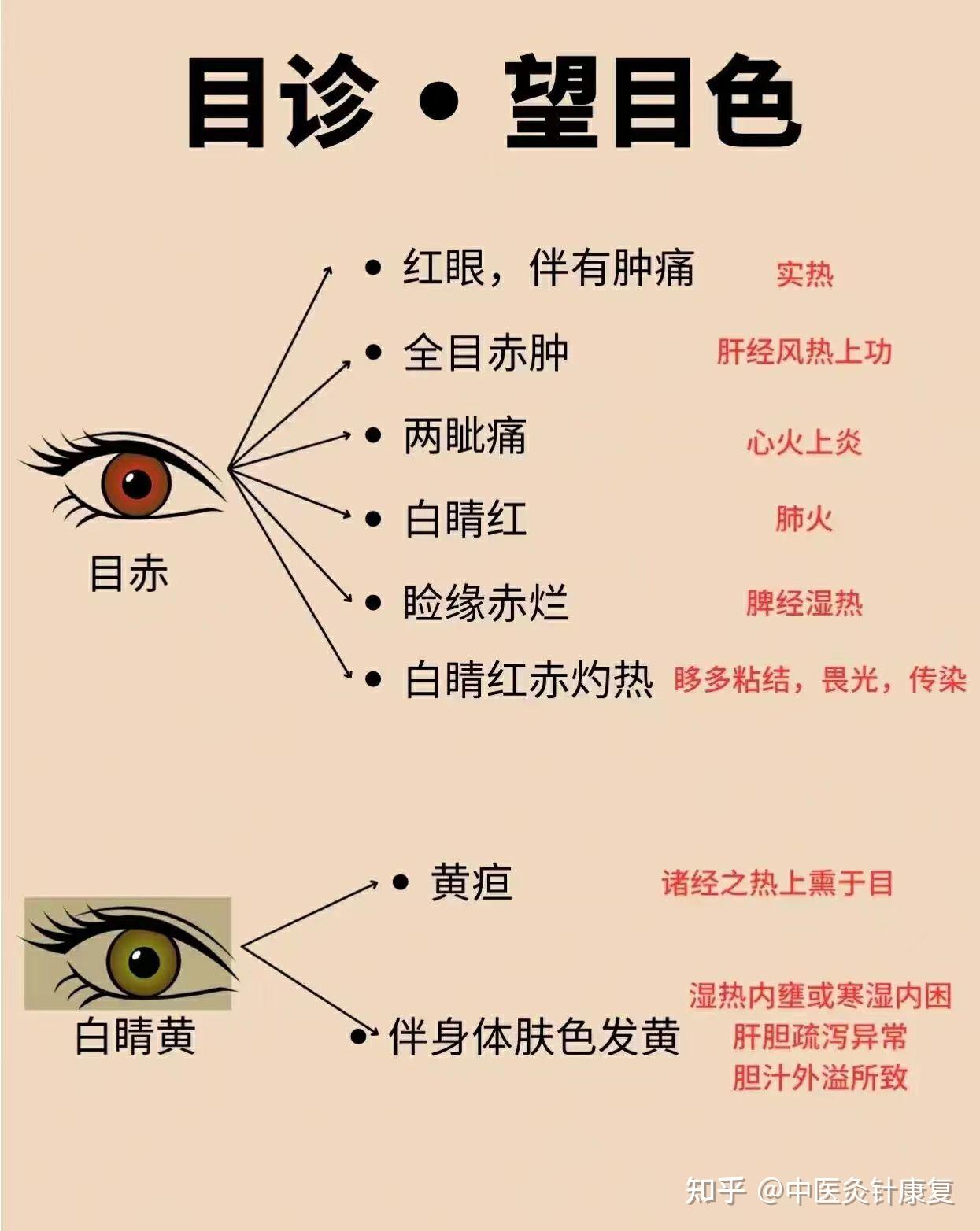 望眼睛——目诊 - 知乎