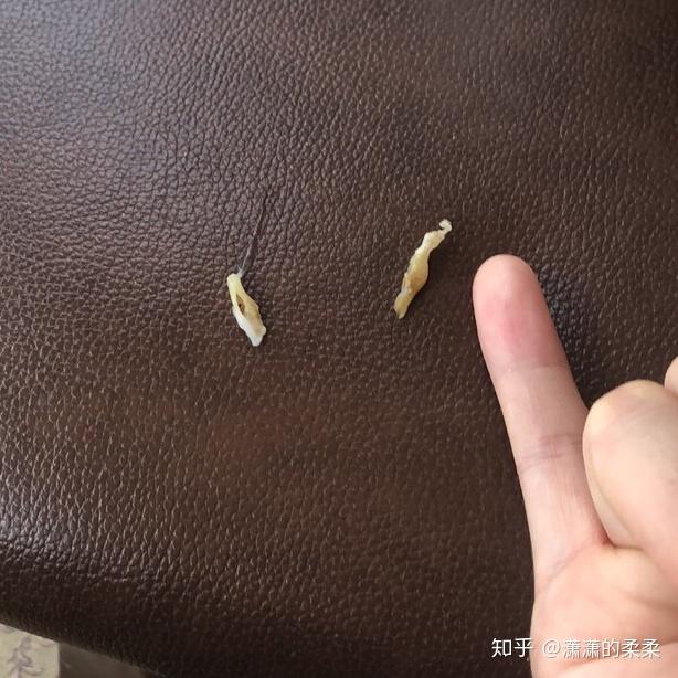 人的鼻屎能大到什么程度? - 知乎