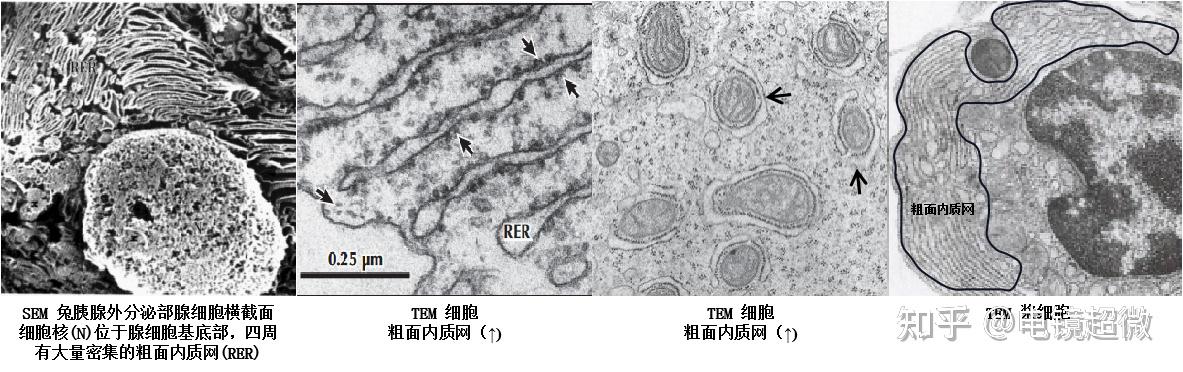 细胞内膜系统-内质网 - 知乎