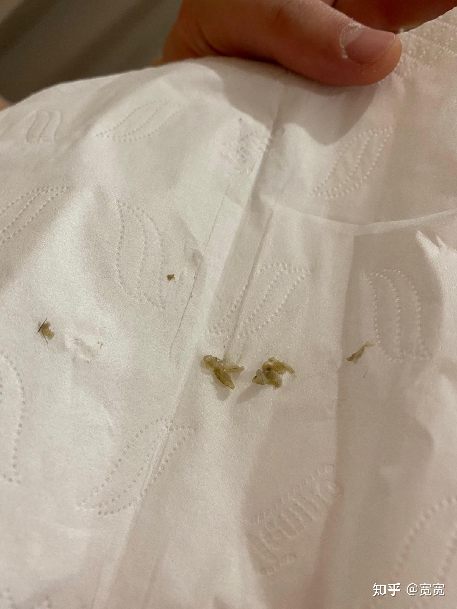 人的鼻屎能大到什么程度