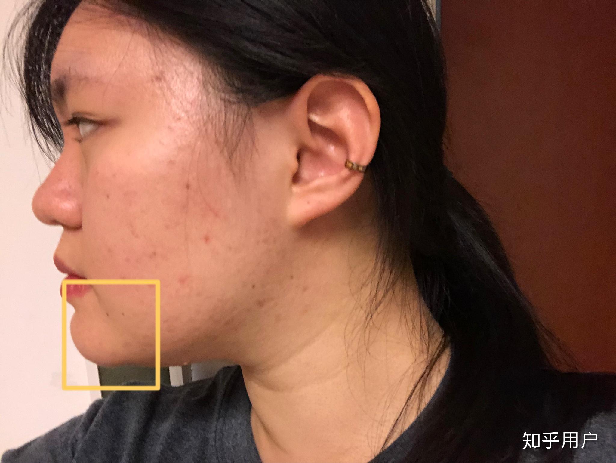 下巴太翘了怎么办? - 知乎