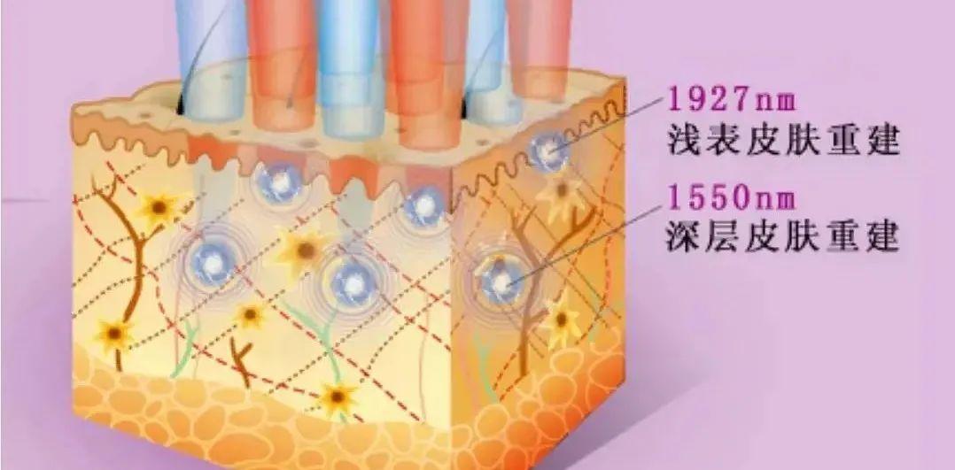 大飞梭小飞梭傻傻分不清楚,你知道怎么选吗? - 知乎
