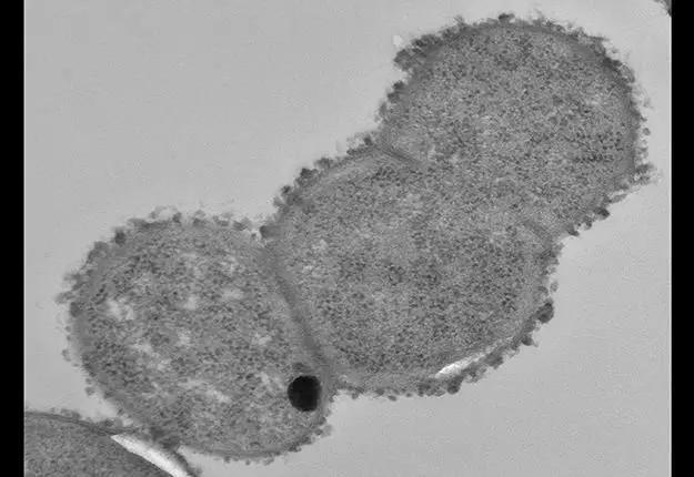 瘤胃球菌属 Ruminococcus - 知乎