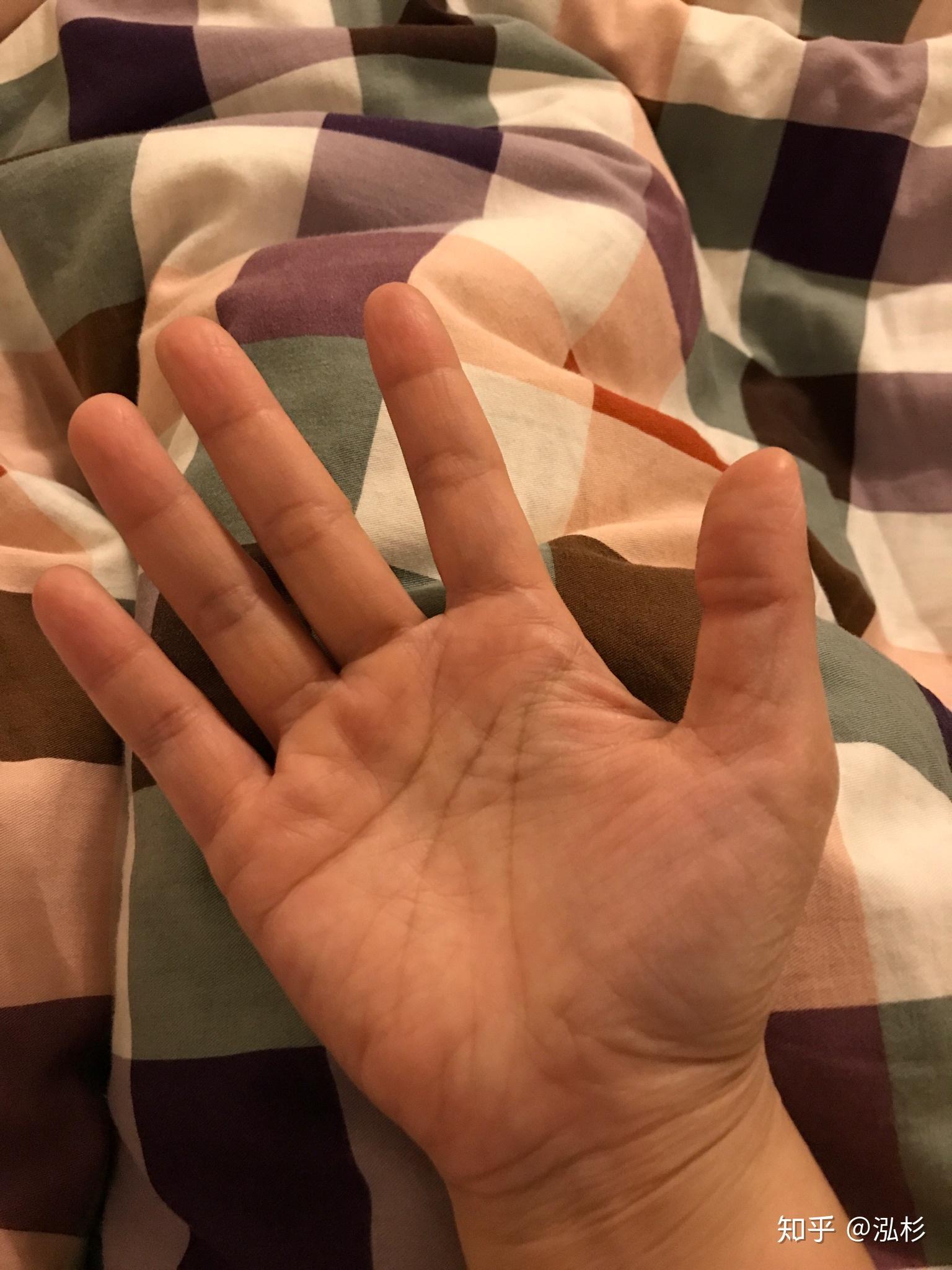 手指短而圆是一种怎样的体验? - 知乎