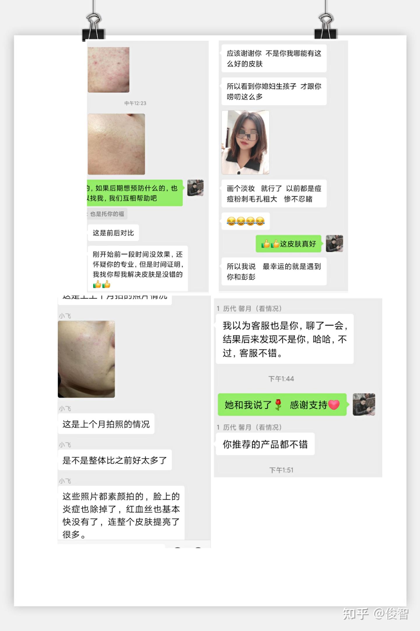 敏感皮肤烂脸修复方法