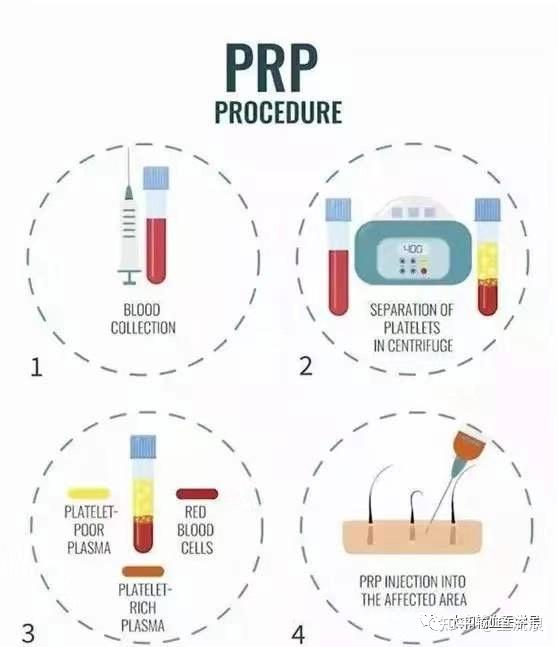 Mprep 干细胞再生医学泰斗黄宗堂博士发明MPRP技术,升级PRP技术,在医疗美容领域应用广(疤痕修复篇) - 知乎