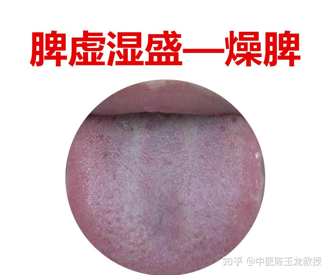 脾虚百病生,老中医教你几个养脾妙招,养好脾胃不生病 - 知乎