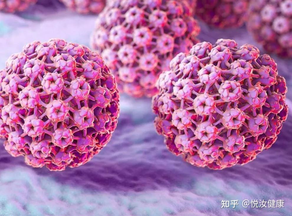 男性hpv 感染常見的症狀有哪些? - 知乎