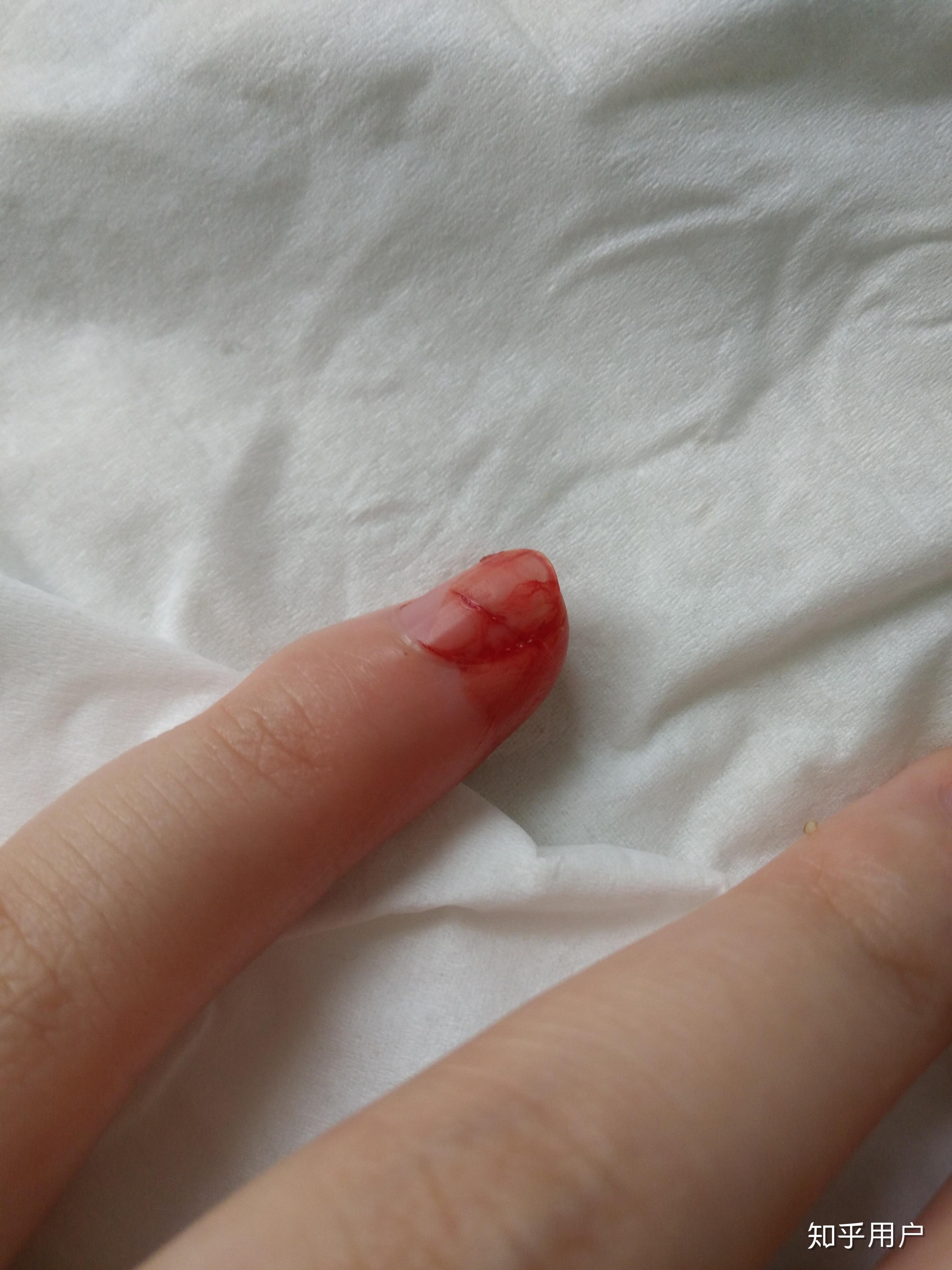 切菜时切到手是一种什么样的体验