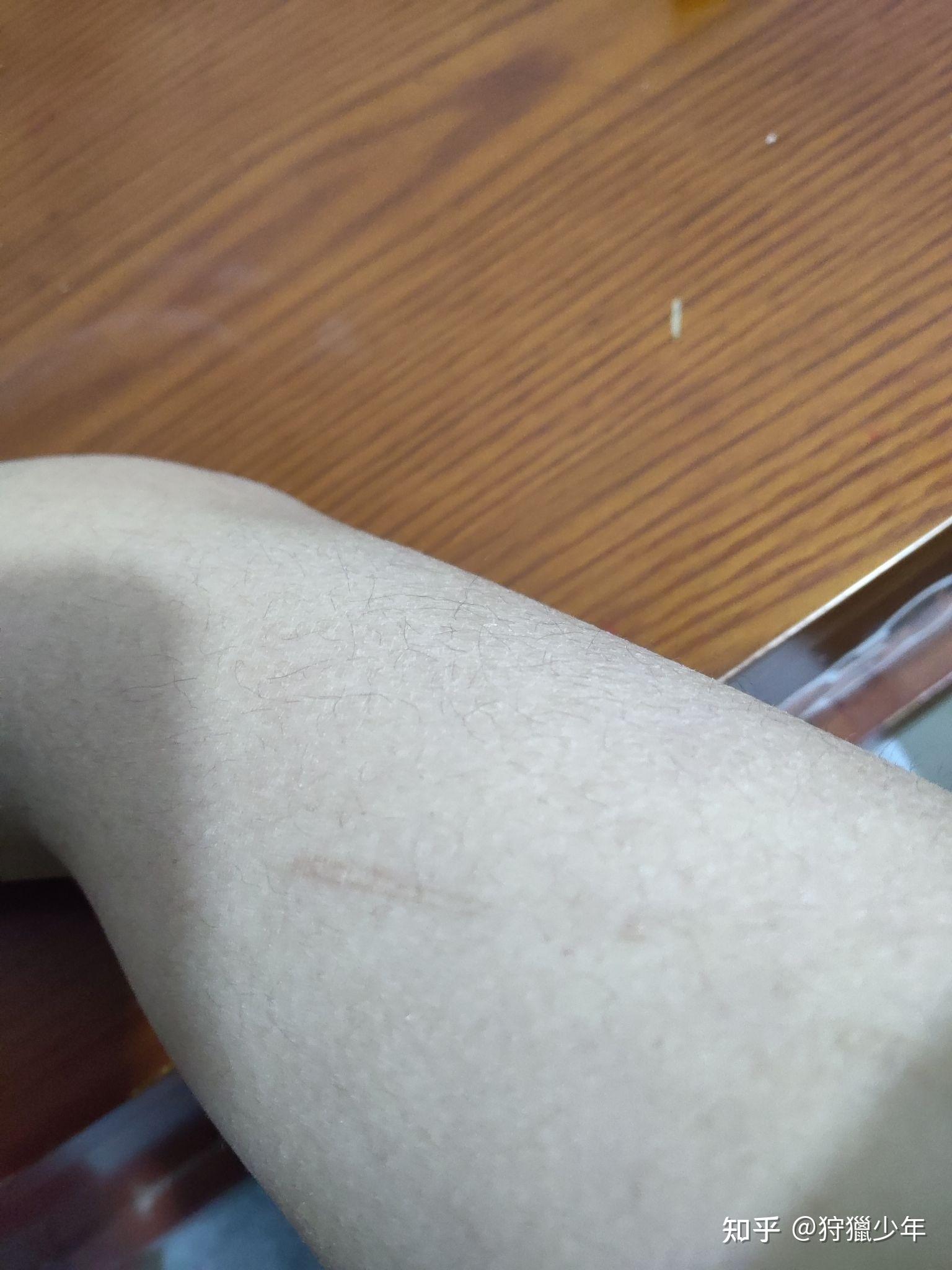 自残留下的疤真的很可笑吗? - 知乎