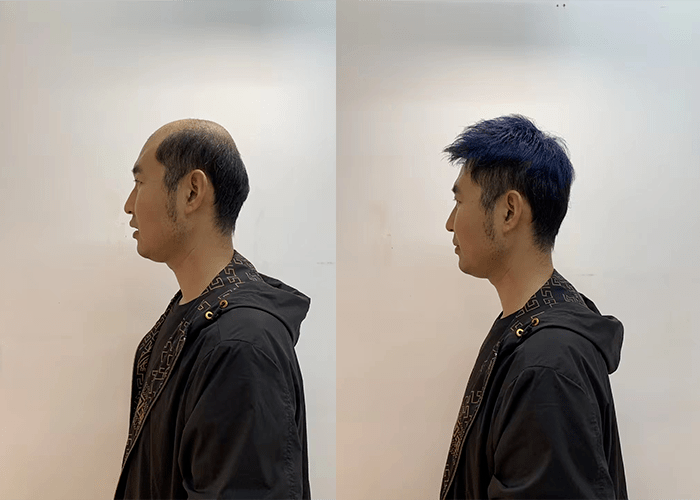 假发片遮白发效果怎么样? - 知乎