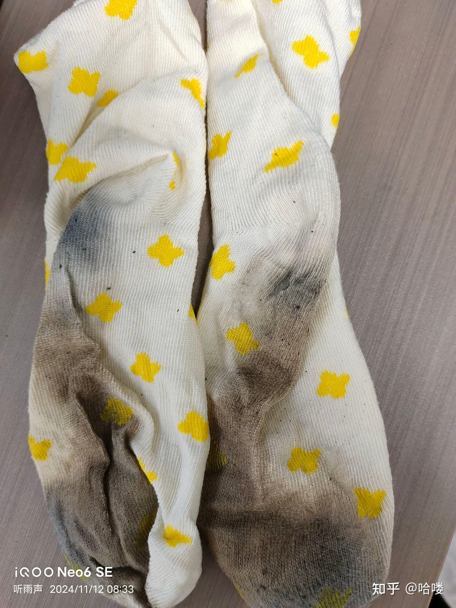 女生在学校体育课后会脚臭吗?