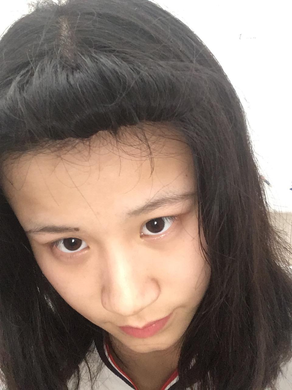 有欧米伽ω下巴,也就是所说的美人沟下巴是一种怎样的体验?