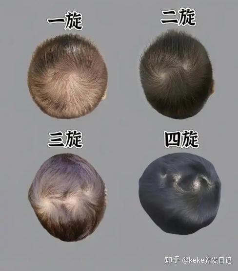为什么每个人的头发都有“旋”？ - 知乎