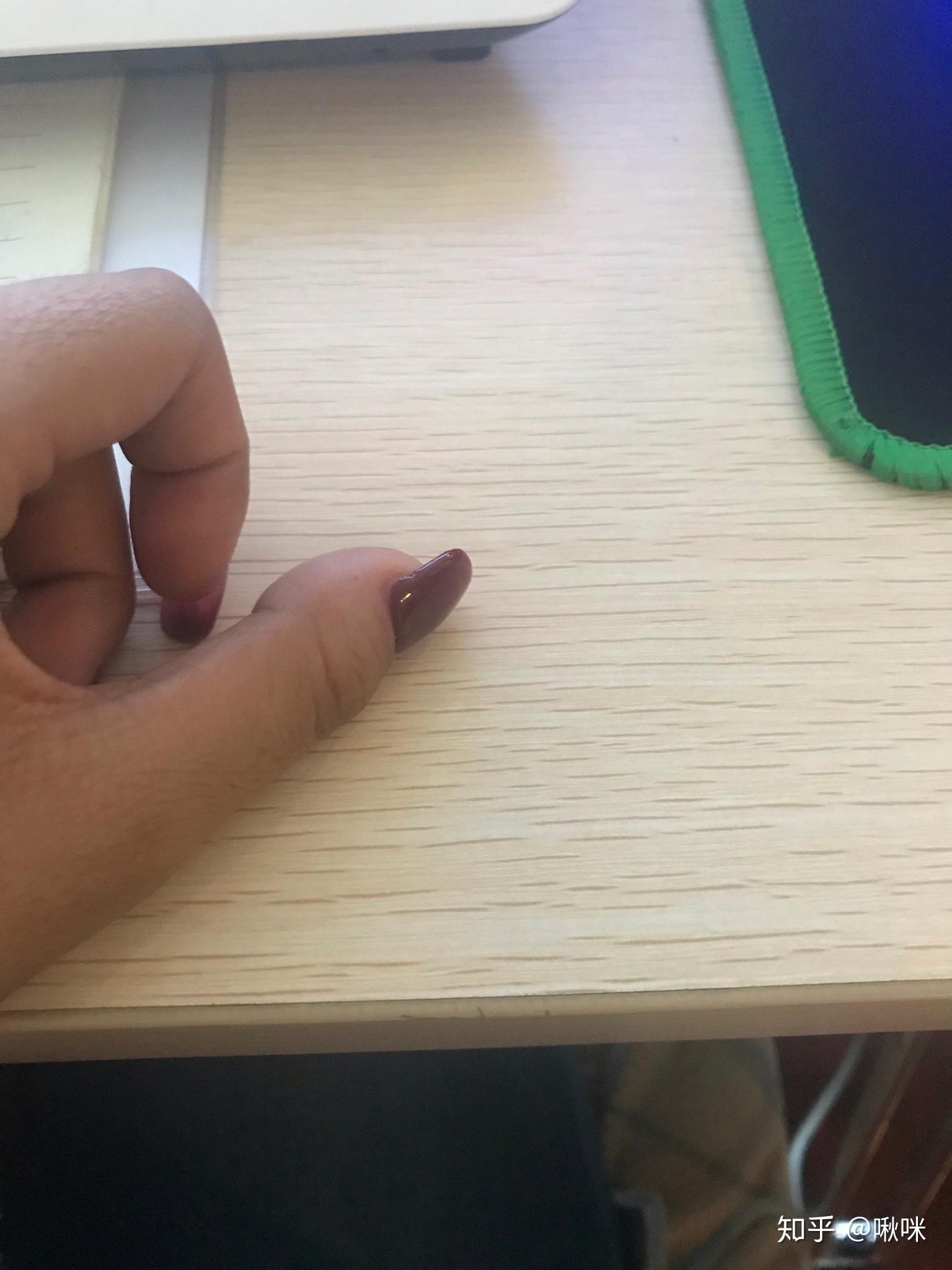 为什么我的大拇指又宽又短