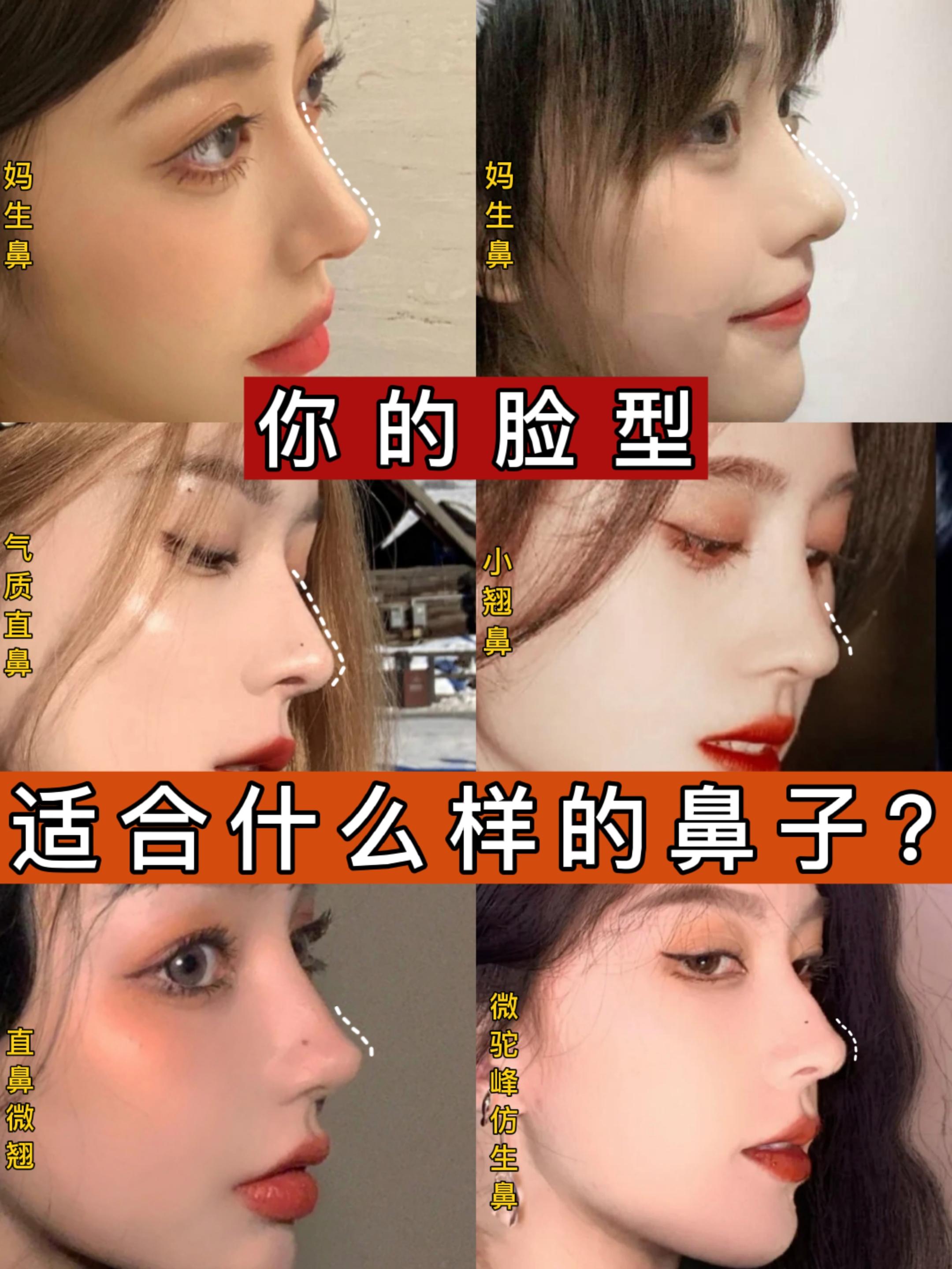 脸型分析，你的脸型适合什么样的鼻子？