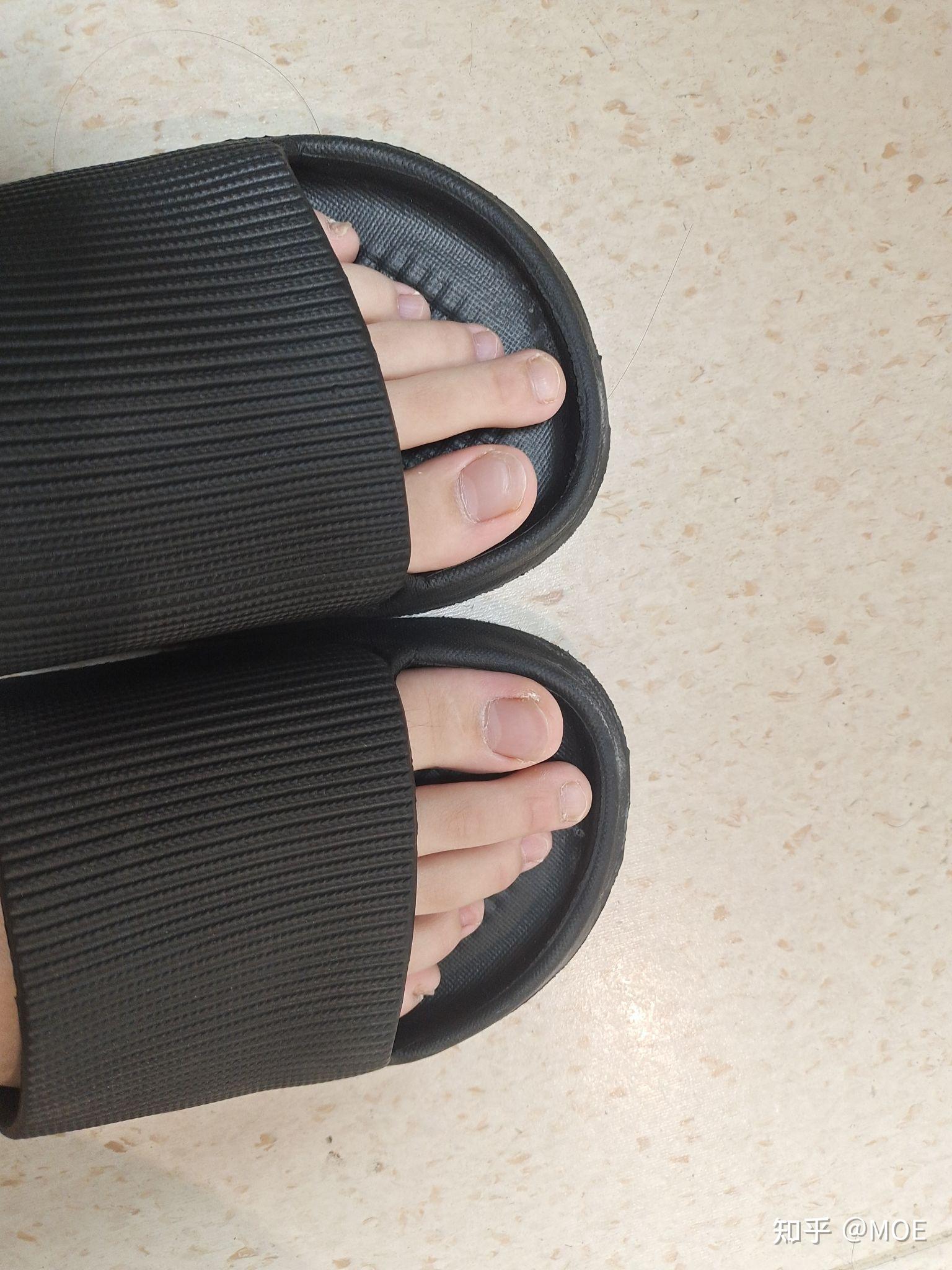 脚二拇指较长的女孩为什么一般都是美女? - 知乎