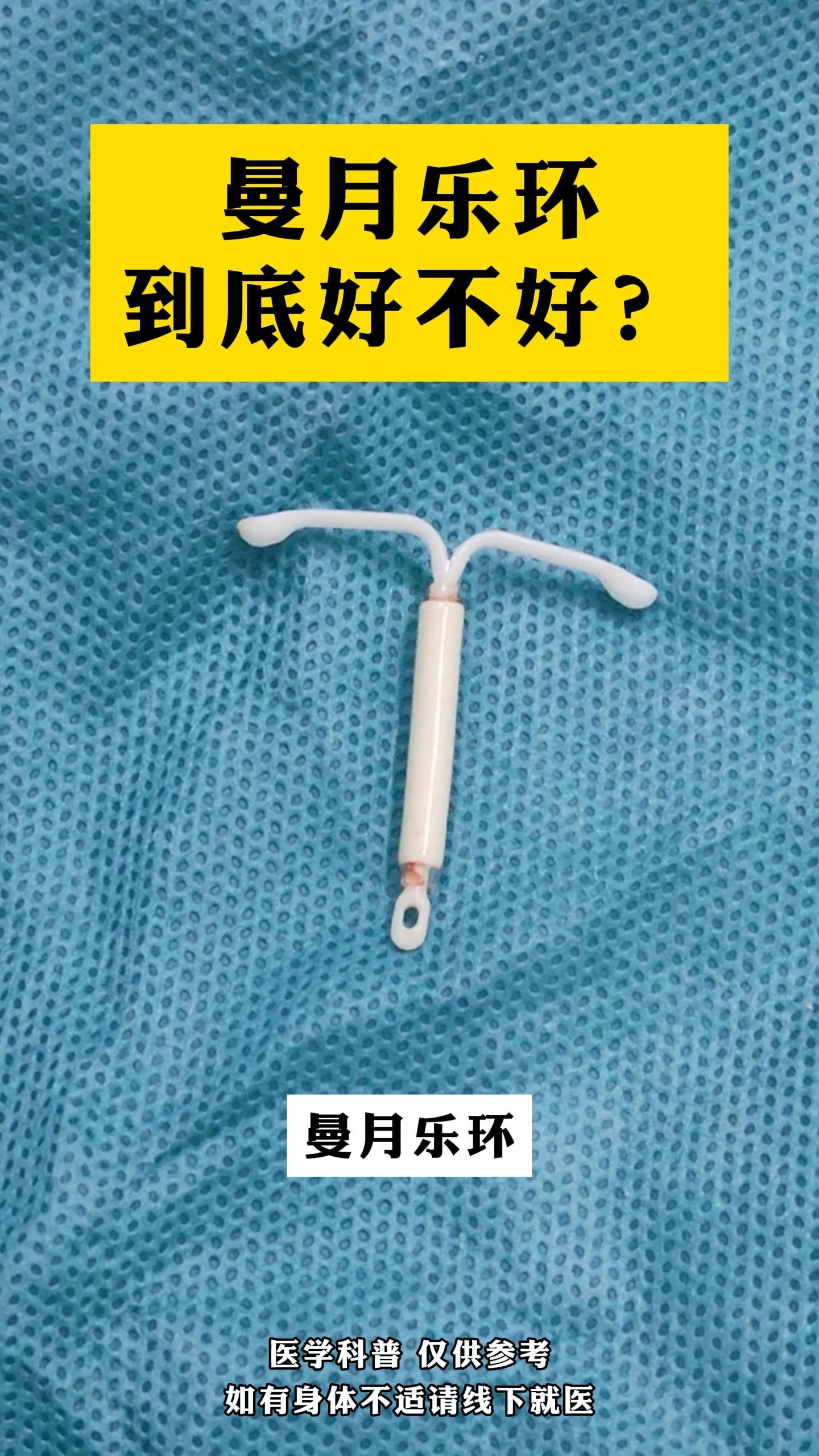 曼月乐环到底好不好?