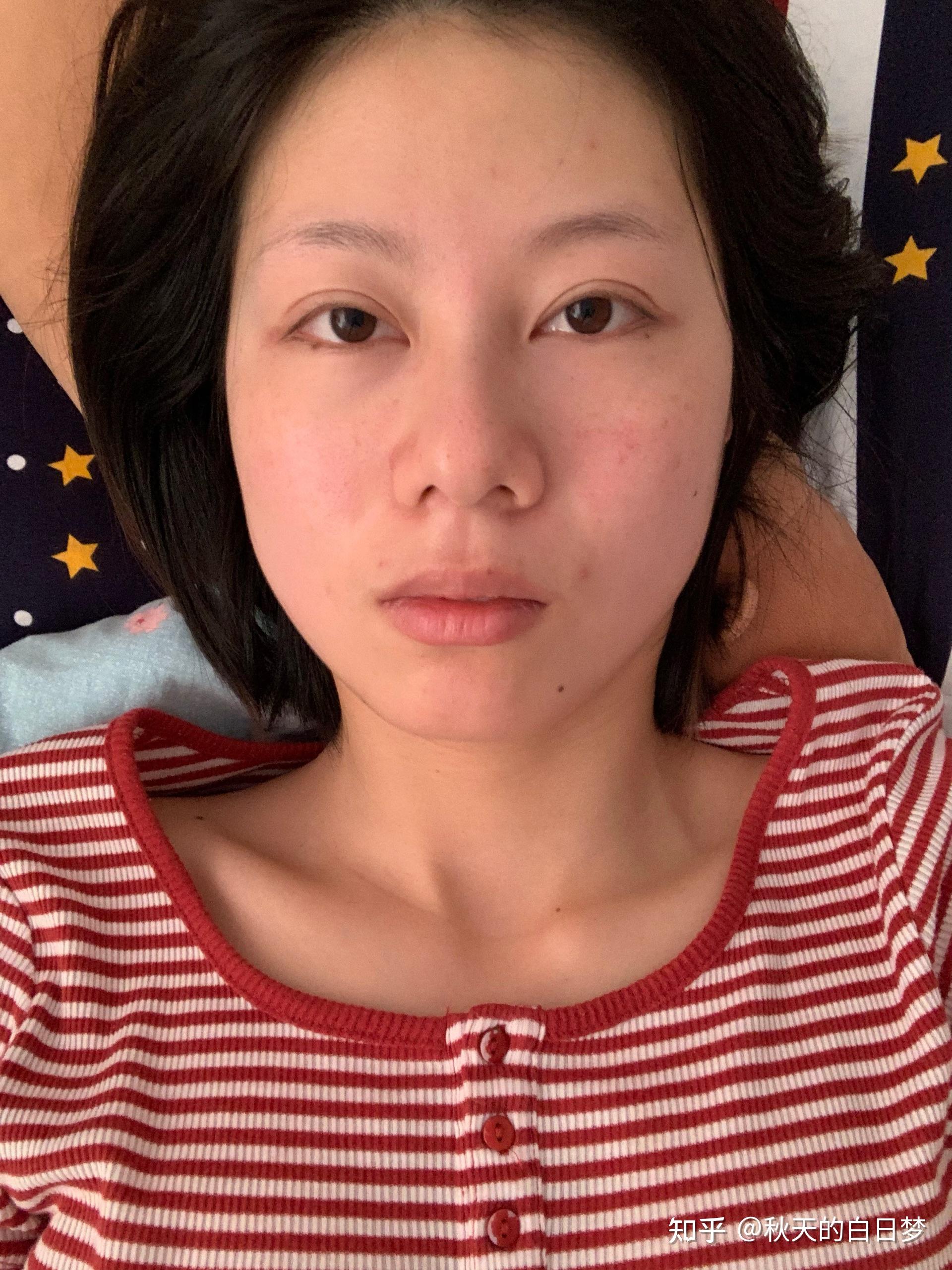 有没有鼻头大,鼻翼宽但是鼻子很挺的人? - 知乎