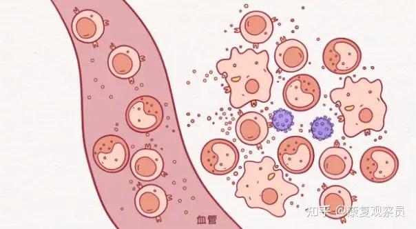 最终引发疼痛的原因是，炎症 - 知乎